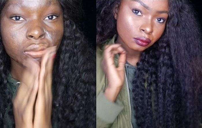Дівчина з сильними опіками обличчя наочно демонструє силу макіяжу (8 фото + відео)