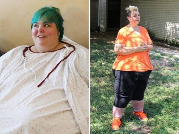 14 фотографий До и После похудения. Эти люди показали свою силу воли! Интересное