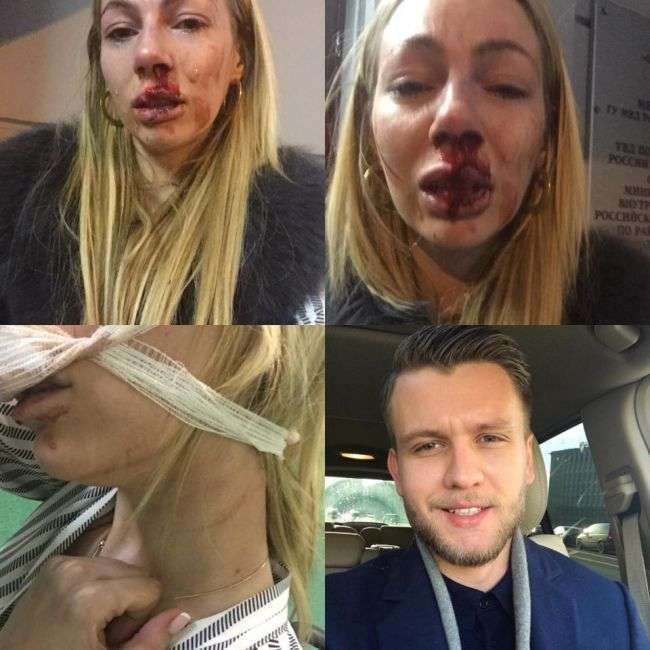 Москвичку жорстоко побили при звільненні з елітного ательє по пошиттю одягу (4 фото)