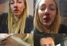 Москвичку жорстоко побили при звільненні з елітного ательє по пошиттю одягу (4 фото)