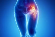 Тріщина шийки стегна: симптоми, діагностика, лікування і наслідки