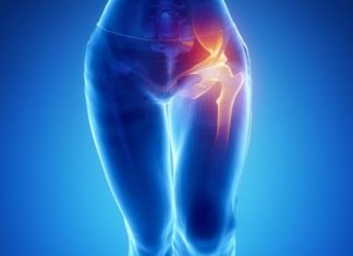 Тріщина шийки стегна: симптоми, діагностика, лікування і наслідки