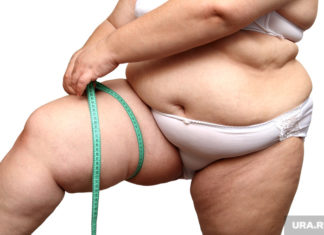 Депутат Держдуми порадив діабетикам схуднути, щоб вилікуватися. «Потрібно займатися собою»