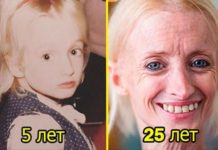 Ця жінка старіє в 8 разів швидше звичайного людини. Ось як вона виглядає