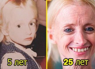 Ця жінка старіє в 8 разів швидше звичайного людини. Ось як вона виглядає