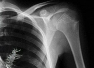 У людському організмі може зрости все що завгодно!