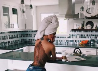 Дівчина з величезною родимкою здалася в нижній білизні, і її обсипали компліментами