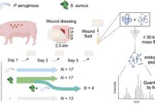Дешифровка Кода Заражения: Алгоритм Позволяет Новым Глазом Глядеть на Инфекции