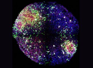 “Міні-мозок” розкриває секрети того, як утворюються ключові клітини мозку в утробі матері