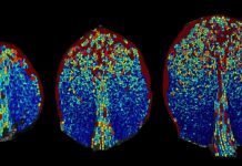 Несподіваний порядок у хаосі рослинних клітин