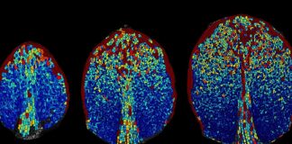 Nieoczekiwany porządek w chaosie komórek roślinnych