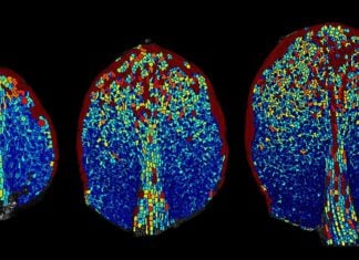 Несподіваний порядок у хаосі рослинних клітин