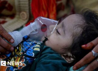 Лікарні Делі реєструють сплеск респіраторних захворювань на тлі погіршення якості повітря