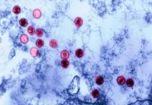 Чому одні хворіють на вірус Епштейна-Барр, а інші ні