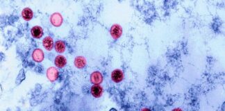 Waarom sommige mensen ziek worden van het Epstein-Barr-virus, terwijl anderen dat niet doen