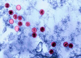 Чому одні хворіють на вірус Епштейна-Барр, а інші ні