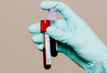 Новий аналіз крові може передбачити ризик хвороби Альцгеймера за десятиліття до появи симптомів