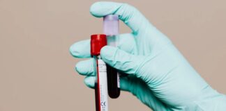 Un nouveau test sanguin pourrait prédire le risque de maladie d’Alzheimer des décennies avant l’apparition des symptômes