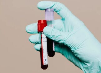 Новий аналіз крові може передбачити ризик хвороби Альцгеймера за десятиліття до появи симптомів