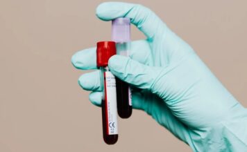 Новий аналіз крові може передбачити ризик хвороби Альцгеймера за десятиліття до появи симптомів