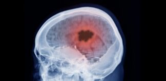 Glitching la barrière hémato-encéphalique avec la vitamine B12
