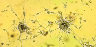 Nanopartikel Berlapis Gula Menyerang Tumor Otak pada Tikus